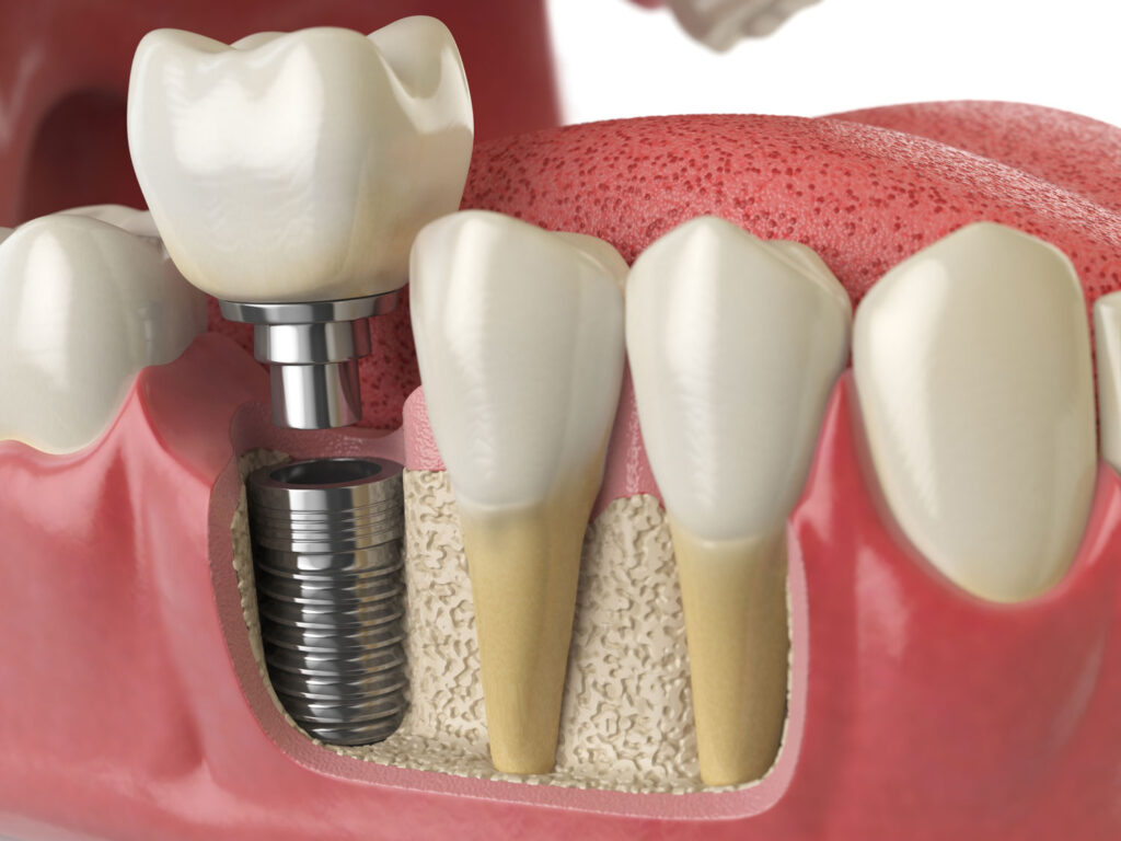 Dr. Vinisha Pandey Dentistry