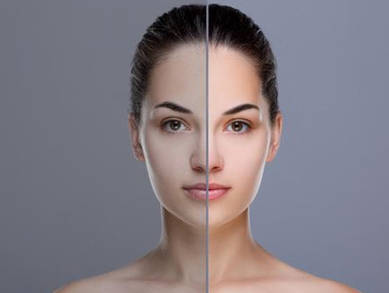 Single Tooth Implant in Kanpur