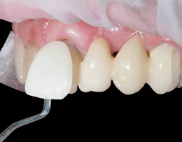 Dr. Vinisha Pandey Dentistry