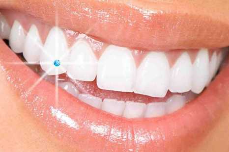 Teeth Jewelry in Kanpur